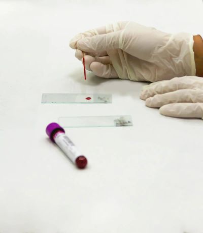 Badania krwi: Dlaczego prewencja to oszczędność?